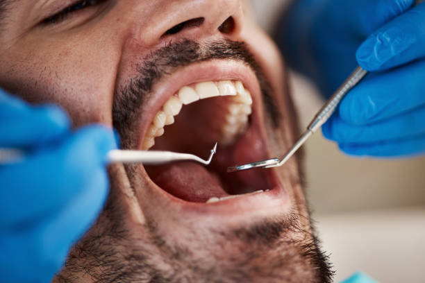 Best Knocked-Out Tooth Emergency  in Romney, WV