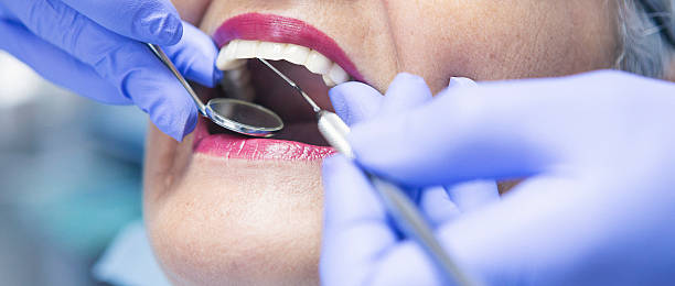 Best Emergency Dental Filling Replacement  in Romney, WV